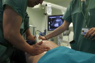 Version Cefalica Un Giro Para Evitar La Cesarea Cuando El Bebe Viene De Nalgas El Mundo