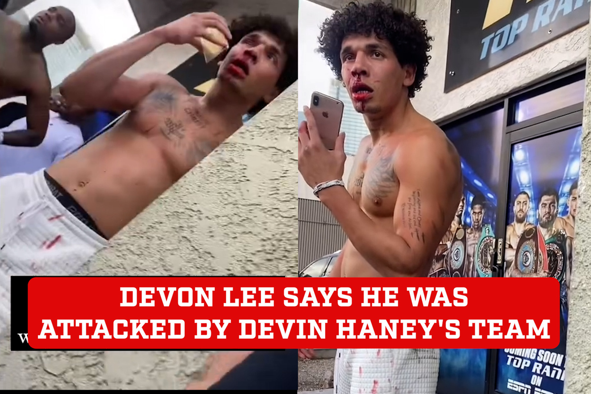 Shocking! Boxer Devon Lee alleges assault by Devin Haney Team