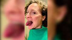 La mujer con la lengua más gorda del mundo: tiene el diámetro de una lata de refresco