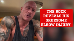 The Rock reveals gruesome elbow injury from filming 'The Smashing Machine'