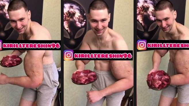 El Popeye Ruso presume de la carne que le han quitado de sus bíceps hinchados con aceite