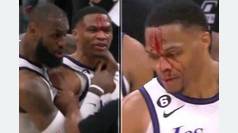 Flagrante falta sangrienta en la NBA: expulsado tras abrirle una brecha en la frente a Westbrook