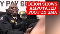 Deion Sanders shows amputated foot on Good Morning America
