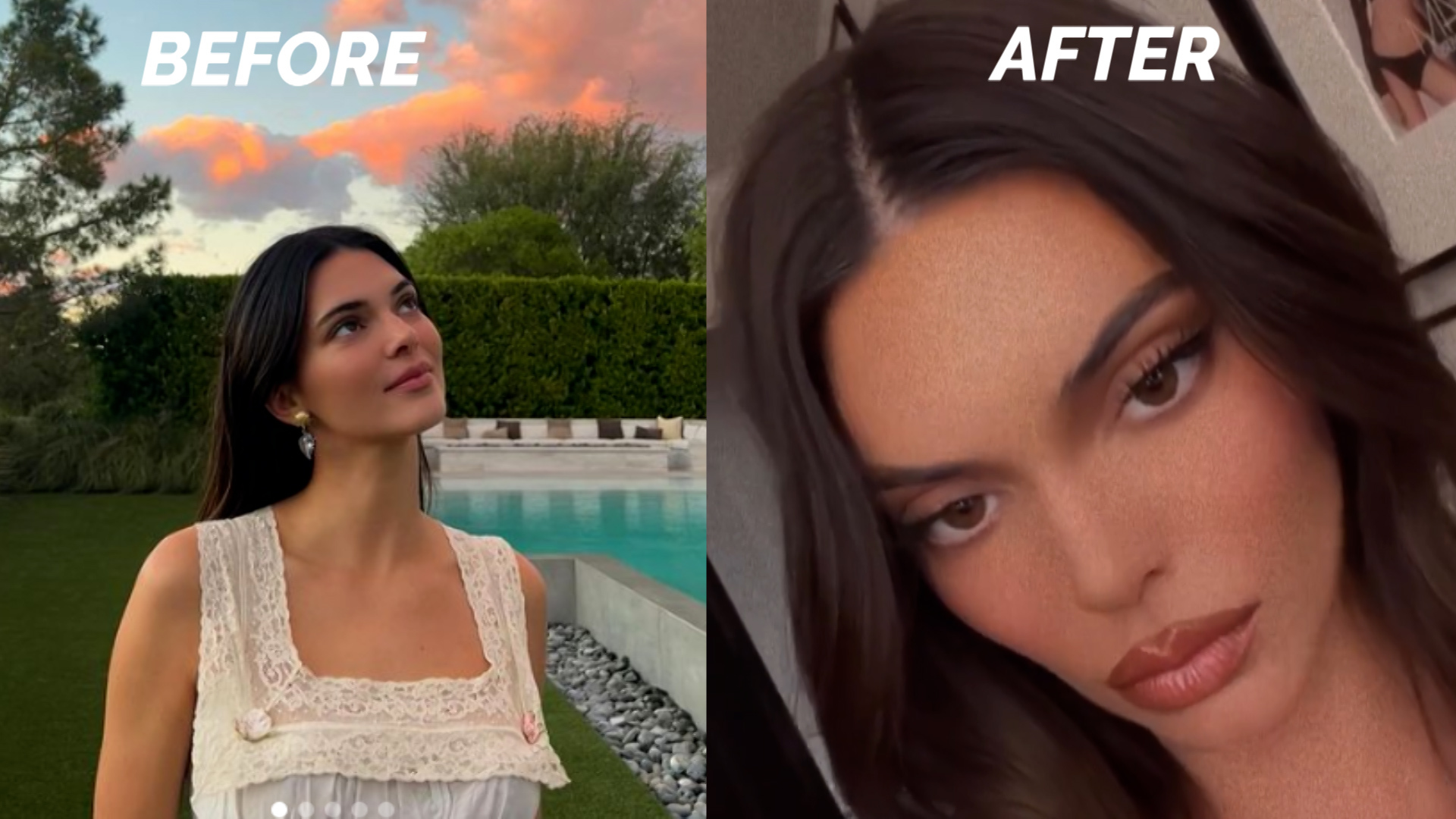Fans Think Kendall Jenner Had 'Secret Surgery' After Her Latest