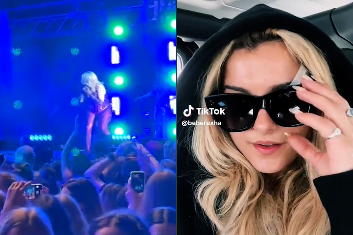 Bebe Rexha shows her injuries after fan smake her in the face with a phone