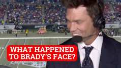 Tom Brady questioned about plastic sugery after TV broadcast debut 
