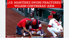 J.D. Martnez's swing causes arm fracture to Willson Contreras in horrific injury scene