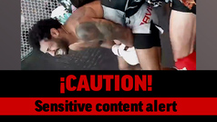 Sensitive Video: Watch Mike Davis' Gruesome Training Injury