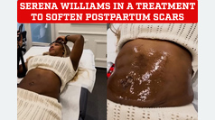 Serena Williams reveals her body with innovative treatment to smooth postpartum scars
