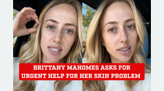 Brittany Mahomes urgently asks for help for her skin problem, can't find a way to solve it