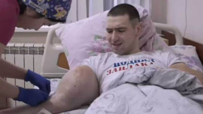 La operación del Popeye Ruso para quitarse los litros de aceite que se inyectó en los bíceps