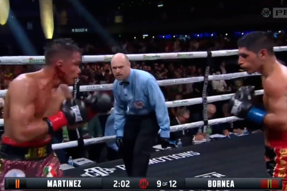 Boxing Boxer's ear explodes during brutal fight, splatters all over