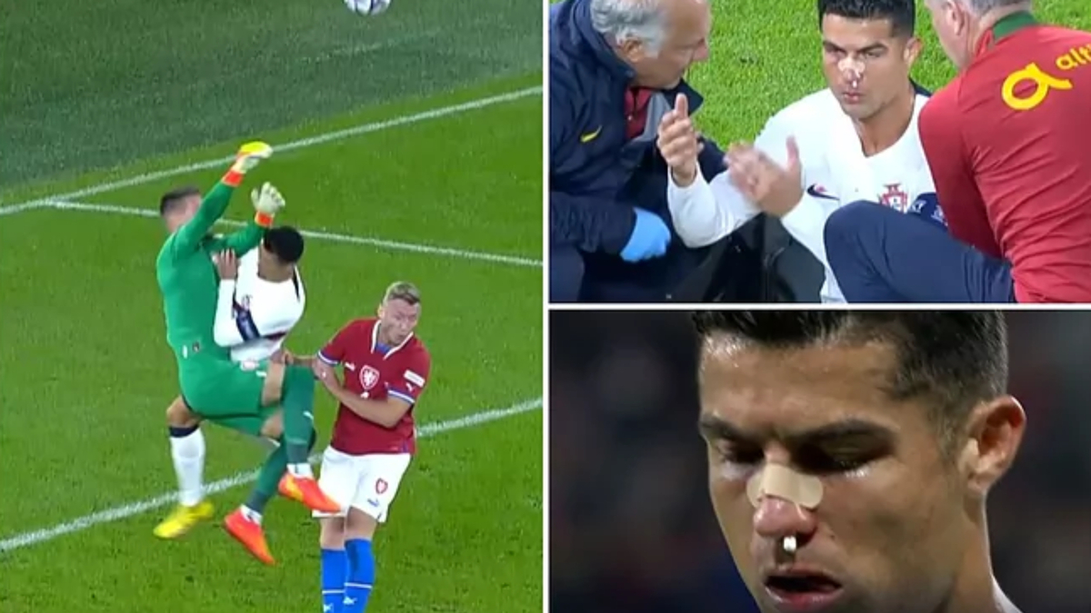 O tremendo golpe em Cristiano Ronaldo que deixou seu rosto fez um cromo