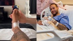 Neymar muestra como sigue la recuperación de su tobillo derecho