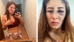 Luchadora Daniela López Mejía denuncia violencia del padre de sus hijas, que es peleador profesional