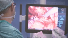 Éxito de la cirugía robótica en una recaída del cáncer de próstata