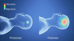 La Clnica Universidad de Navarra abre una unidad de Protonterapia